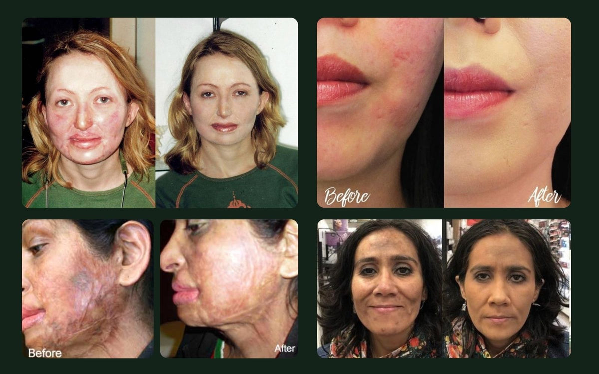Unveiling the Healing Brush: Sweet LeiLani’s Transformative Journey with Paramedical Makeup - Sweet LeiLani